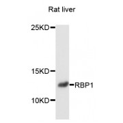 Western blot analysis of extracts of rat liver, using RBP1 antibody (abx135947) at 1/1000 dilution.