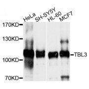 Western blot analysis of extracts of various cell lines, using TBL3 antibody (abx135961) at 1/1000 dilution.