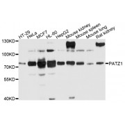 Western blot analysis of extracts of various cell lines, using PATZ1 antibody (abx135971) at 1/1000 dilution.