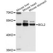 Western blot analysis of extracts of various cell lines, using POU2F3 Antibody (abx135972) at 1/1000 dilution.