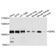 Western blot analysis of extracts of various cell lines, using DDR2 antibody (abx135978) at 1/1000 dilution.
