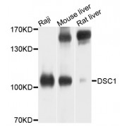 Western blot analysis of extracts of various cell lines, using DSC1 antibody (abx135979) at 1/1000 dilution.