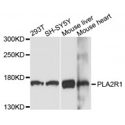 Western blot analysis of extracts of various cell lines, using PLA2R1 antibody (abx135986) at 1/1000 dilution.