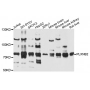 Western blot analysis of extracts of various cell lines, using PLXNB2 antibody (abx135987) at 1/1000 dilution.