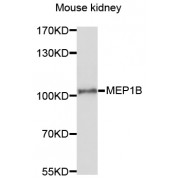 Western blot analysis of extracts of mouse kidney, using MEP1B antibody (abx136003) at 1/1000 dilution.
