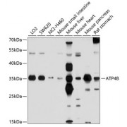 WB analysis of extracts of various cell lines, using ATP4B antibody (abx136016) at 1/1000 dilution.