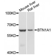 Western blot analysis of extracts of various cell lines, using BTN1A1 antibody (abx136017) at 1/1000 dilution.