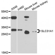 Western blot analysis of extracts of various cell lines, using SLC31A1 antibody (abx136019) at 1/1000 dilution.