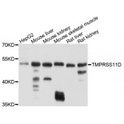 Western blot analysis of extracts of various cell lines, using TMPRSS11D antibody (abx136042) at 1/1000 dilution.