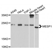 Western blot analysis of extracts of various cell lines, using MESP1 antibody (abx136058) at 1/1000 dilution.