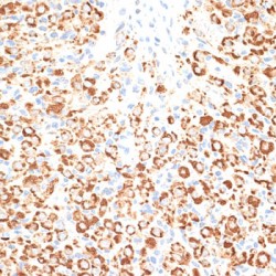 Kelch-Like Protein 9 (KLHL9) Antibody