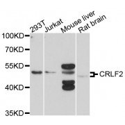 Western blot analysis of extracts of various cell lines, using CRLF2 antibody (abx136062) at 1/1000 dilution.