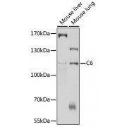 Western blot analysis of extracts of various cell lines, using C6 antibody (abx136078) at 1/1000 dilution.