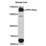 Western blot analysis of extracts of mouse liver, using PPP1R3A antibody (abx136079) at 1/1000 dilution.