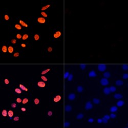 Histone H3K27AC Antibody