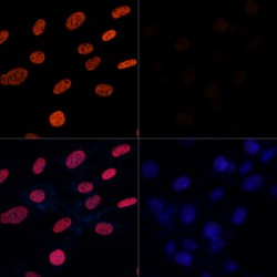 Histone H3K27AC Antibody