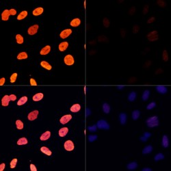 Histone H3K27AC Antibody