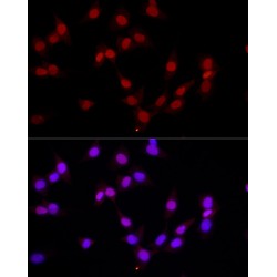 Histone H3K4me1 Antibody