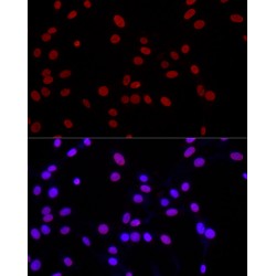 Histone H3K4me1 Antibody