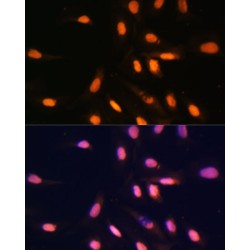 Histone H3K4me1 Antibody