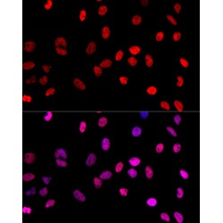 Histone H3K4me1 Antibody
