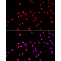 Histone H3K4me1 Antibody