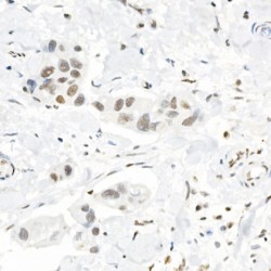 Histone H3K4me3 Antibody