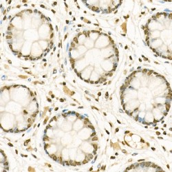 Histone H3K9me1 Antibody