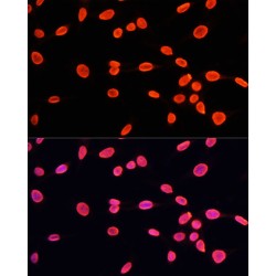 Histone H3K9me1 Antibody