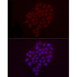 Histone H3K9me2 Antibody