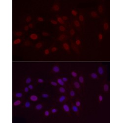 Histone H3K9me2 Antibody