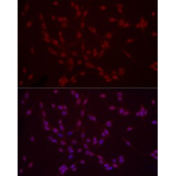 Histone H3K9me2 Antibody