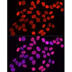 Histone H3K9me3 Antibody
