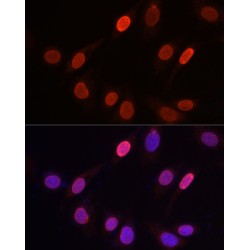 Histone H3K9me3 Antibody