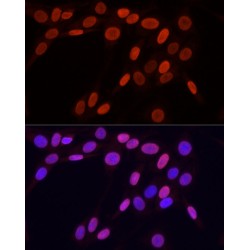 Histone H3K9me3 Antibody
