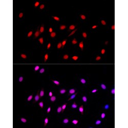Histone H3K27me1 Antibody