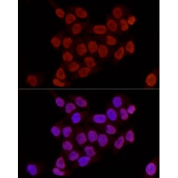 Histone H3K27me2 Antibody