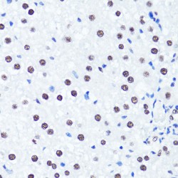 Histone H3R2me2s Antibody