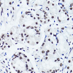 Histone H3R2me2s Antibody