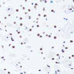 Histone H3R2me2s Antibody