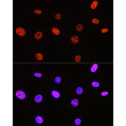 Histone H3R2me2s Antibody