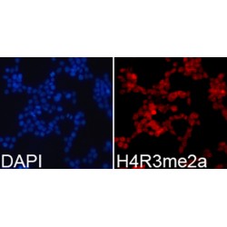 Histone H4R3me2a Antibody