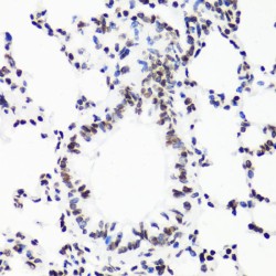 Histone H3R17me1 Antibody