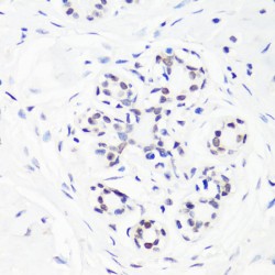 Histone H3R17me1 Antibody