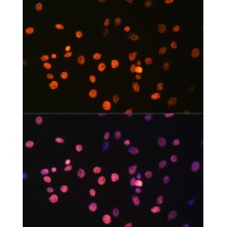 Histone H3R17me1 Antibody