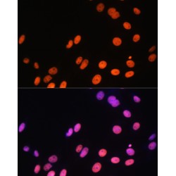 Histone H3R17me1 Antibody