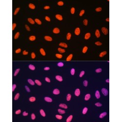 Histone H3R17me1 Antibody
