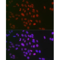 Histone H3R26me2s Antibody