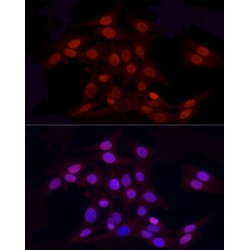 Histone H3R2me2a Antibody