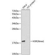 abx000034